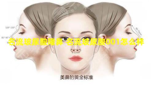 名流玻尿酸隆鼻 名流玻尿酸001怎么样